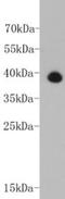 Troponin T2, Cardiac Type antibody, NBP2-67211, Novus Biologicals, Western Blot image 