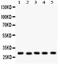 Snail Family Transcriptional Repressor 1 antibody, PB9399, Boster Biological Technology, Western Blot image 