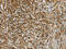 Salt Inducible Kinase 1 antibody, CSB-PA211930, Cusabio, Immunohistochemistry paraffin image 