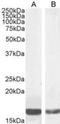 Translocator protein antibody, NBP1-51934, Novus Biologicals, Western Blot image 