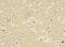 Cytochrome P450 Family 2 Subfamily E Member 1 antibody, LS-C369501, Lifespan Biosciences, Immunohistochemistry frozen image 