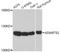 ADAM Metallopeptidase With Thrombospondin Type 1 Motif 2 antibody, A10272, ABclonal Technology, Western Blot image 
