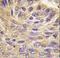 Protein Tyrosine Phosphatase Non-Receptor Type 9 antibody, LS-C100980, Lifespan Biosciences, Immunohistochemistry paraffin image 