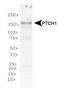 Patched 1 antibody, NBP1-71662, Novus Biologicals, Western Blot image 