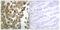 Protein Kinase C Delta antibody, PA5-38384, Invitrogen Antibodies, Immunohistochemistry paraffin image 