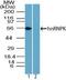 HNRPK antibody, PA5-23437, Invitrogen Antibodies, Western Blot image 