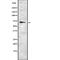 Receptor Like Tyrosine Kinase antibody, abx218411, Abbexa, Western Blot image 