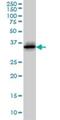 Cyclin Dependent Kinase 6 antibody, H00001021-M01, Novus Biologicals, Western Blot image 