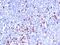Immunoglobulin Heavy Constant Gamma 1 (G1m Marker) antibody, MBS438254, MyBioSource, Immunohistochemistry paraffin image 