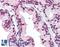 DEAD-Box Helicase 3 X-Linked antibody, LS-B2348, Lifespan Biosciences, Immunohistochemistry paraffin image 