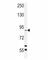 Receptor Interacting Serine/Threonine Kinase 4 antibody, F40006-0.4ML, NSJ Bioreagents, Western Blot image 