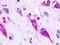 Probable G-protein coupled receptor 22 antibody, LS-A109, Lifespan Biosciences, Immunohistochemistry paraffin image 