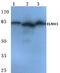 Engulfment And Cell Motility 1 antibody, A03091, Boster Biological Technology, Western Blot image 
