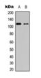 Protein Kinase D1 antibody, orb393091, Biorbyt, Western Blot image 