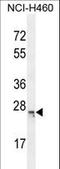 BMERB Domain Containing 1 antibody, LS-C166977, Lifespan Biosciences, Western Blot image 