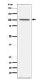 DEAD-Box Helicase 20 antibody, M05291, Boster Biological Technology, Western Blot image 