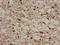 Sortilin Related Receptor 1 antibody, LS-C671708, Lifespan Biosciences, Immunohistochemistry paraffin image 