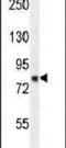 Zinc Finger FYVE-Type Containing 28 antibody, PA5-24077, Invitrogen Antibodies, Western Blot image 