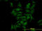 Cyclin Dependent Kinase 4 antibody, LS-C196880, Lifespan Biosciences, Immunofluorescence image 