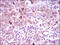 Helicase, Lymphoid Specific antibody, orb329871, Biorbyt, Immunohistochemistry paraffin image 