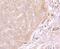 ATP Synthase F1 Subunit Alpha antibody, M03598, Boster Biological Technology, Immunohistochemistry paraffin image 