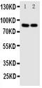 Nuclear Factor Of Activated T Cells 1 antibody, PA1663, Boster Biological Technology, Western Blot image 