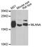 Melan-A antibody, A6290, ABclonal Technology, Western Blot image 