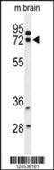 KIAA0417 antibody, 64-101, ProSci, Western Blot image 