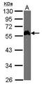 E2F-1 antibody, MA1-23202, Invitrogen Antibodies, Western Blot image 