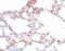 MRE11 Homolog, Double Strand Break Repair Nuclease antibody, PA5-20870, Invitrogen Antibodies, Immunohistochemistry frozen image 