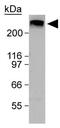 ATM Serine/Threonine Kinase antibody, GTX30104, GeneTex, Western Blot image 