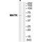 Megakaryocyte-Associated Tyrosine Kinase antibody, PA5-50179, Invitrogen Antibodies, Western Blot image 