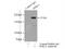 Phosphatidylinositol 4-Kinase Alpha antibody, 12411-1-AP, Proteintech Group, Immunoprecipitation image 