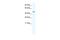 DEAD-Box Helicase 49 antibody, A15881, Boster Biological Technology, Western Blot image 