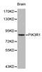 Phosphoinositide-3-Kinase Regulatory Subunit 1 antibody, LS-C192511, Lifespan Biosciences, Western Blot image 