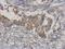 Mitogen-Activated Protein Kinase Kinase Kinase 3 antibody, LS-C155322, Lifespan Biosciences, Immunohistochemistry paraffin image 