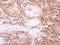 Inosine Triphosphatase antibody, GTX106635, GeneTex, Immunohistochemistry paraffin image 