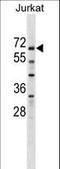Zinc Finger And SCAN Domain Containing 25 antibody, LS-C160888, Lifespan Biosciences, Western Blot image 