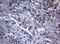 TNKS antibody, LS-C175670, Lifespan Biosciences, Immunohistochemistry paraffin image 