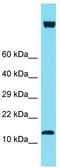 IQ Motif Containing F6 antibody, TA337362, Origene, Western Blot image 