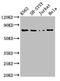 Protein Kinase C Beta antibody, LS-C671010, Lifespan Biosciences, Western Blot image 