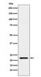 Transgelin antibody, M03962-1, Boster Biological Technology, Western Blot image 