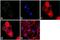 Protein Tyrosine Kinase 2 antibody, NBP2-68146, Novus Biologicals, Immunocytochemistry image 