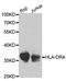 Major Histocompatibility Complex, Class II, DR Alpha antibody, LS-B13364, Lifespan Biosciences, Western Blot image 