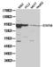 Signal Transducer And Activator Of Transcription 5B antibody, LS-C192253, Lifespan Biosciences, Western Blot image 