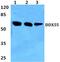 DEAD-Box Helicase 55 antibody, A12850-1, Boster Biological Technology, Western Blot image 