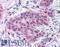 Matrix Metallopeptidase 13 antibody, LS-A1552, Lifespan Biosciences, Immunohistochemistry paraffin image 