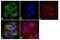 ERBB2 antibody, MA5-11367, Invitrogen Antibodies, Immunofluorescence image 