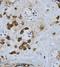 Fibrinogen Alpha Chain antibody, A00816-3, Boster Biological Technology, Immunohistochemistry paraffin image 