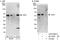 ACD Shelterin Complex Subunit And Telomerase Recruitment Factor antibody, A303-069A, Bethyl Labs, Western Blot image 